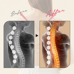 猫背矯正ベルト|肩甲骨サポーター×巻き肩シェイパー| 脇肉解消 装着簡単|調節でストレスフリー【ディアドリス】